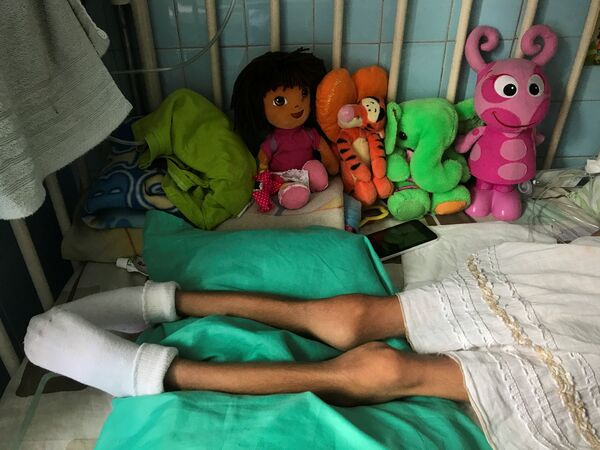 Истощенная девочка лежит на кровати в детской больнице в Каракасе - Sputnik Литва