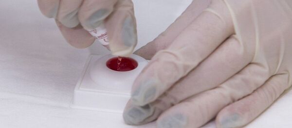 Тест на СПИД Тест на СПИД - Sputnik Lietuva