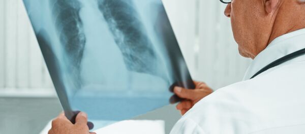 Рентген легких - Sputnik Lietuva