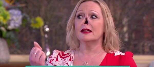 Женщина без носа - Sputnik Литва