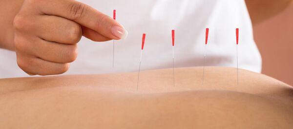 Лечение иглотерапией - Sputnik Литва
